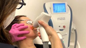 ringiovanimento viso