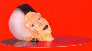 loredana berté medicina estetica