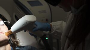 biorivitalizzazione viso